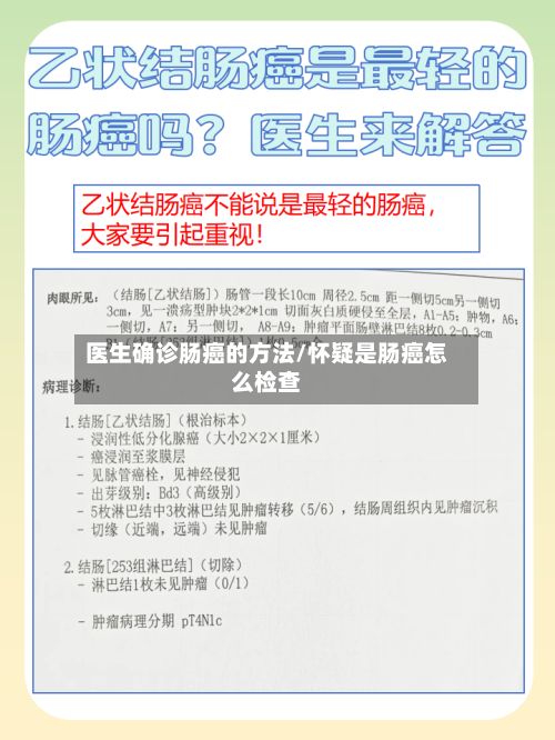 医生确诊肠癌的方法/怀疑是肠癌怎么检查