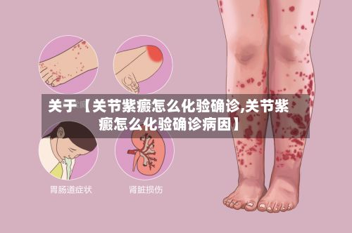 关于【关节紫癜怎么化验确诊,关节紫癜怎么化验确诊病因】