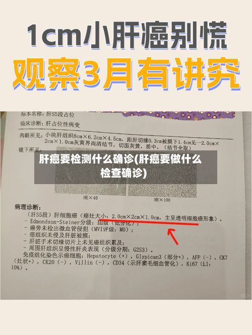 肝癌要检测什么确诊(肝癌要做什么检查确诊)-第2张图片