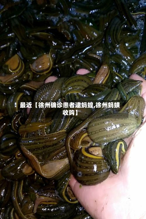最近【徐州确诊患者逮蚂蝗,徐州蚂蟥收购】-第2张图片