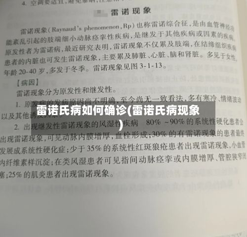 雷诺氏病如何确诊(雷诺氏病现象)-第1张图片