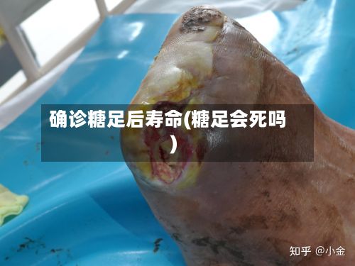 确诊糖足后寿命(糖足会死吗)