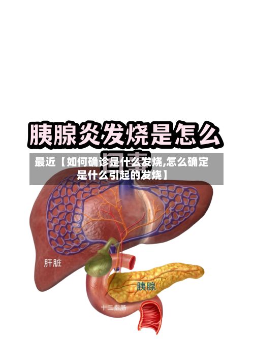 最近【如何确诊是什么发烧,怎么确定是什么引起的发烧】-第3张图片