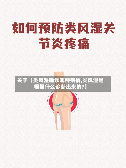 关于【类风湿确诊哪种病情,类风湿是根据什么诊断出来的?】-第1张图片