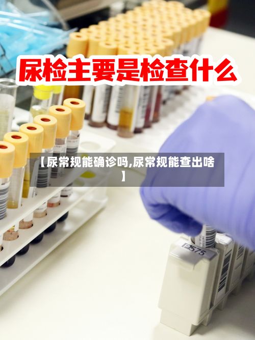 【尿常规能确诊吗,尿常规能查出啥】-第2张图片