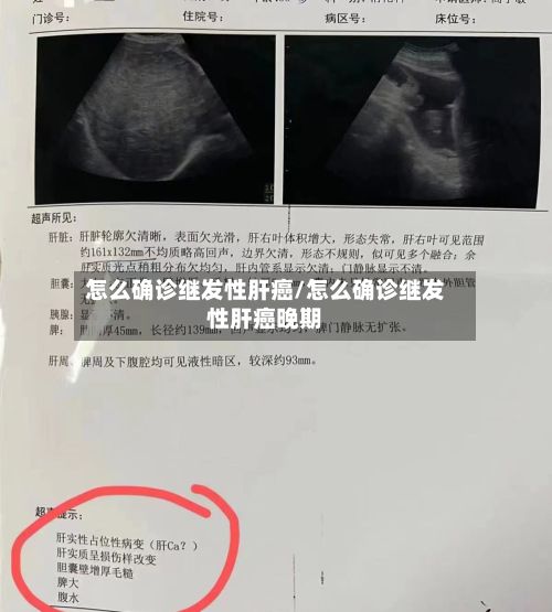 怎么确诊继发性肝癌/怎么确诊继发性肝癌晚期-第1张图片