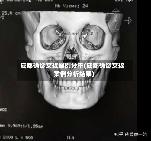 成都确诊女孩案例分析(成都确诊女孩案例分析结果)